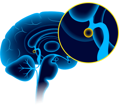 Creating Quantum Attraction in our pineal glands (third eye).